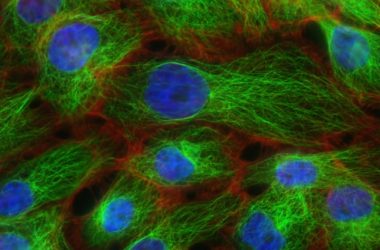 (ACPs) Anticancer Peptides are therapeutic agents
