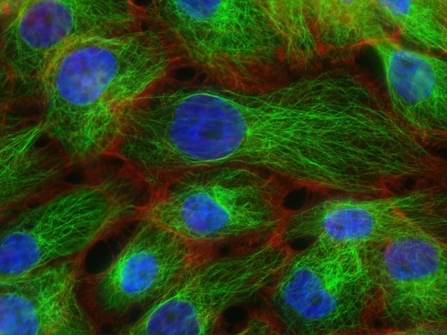 (ACPs) Anticancer Peptides are therapeutic agents